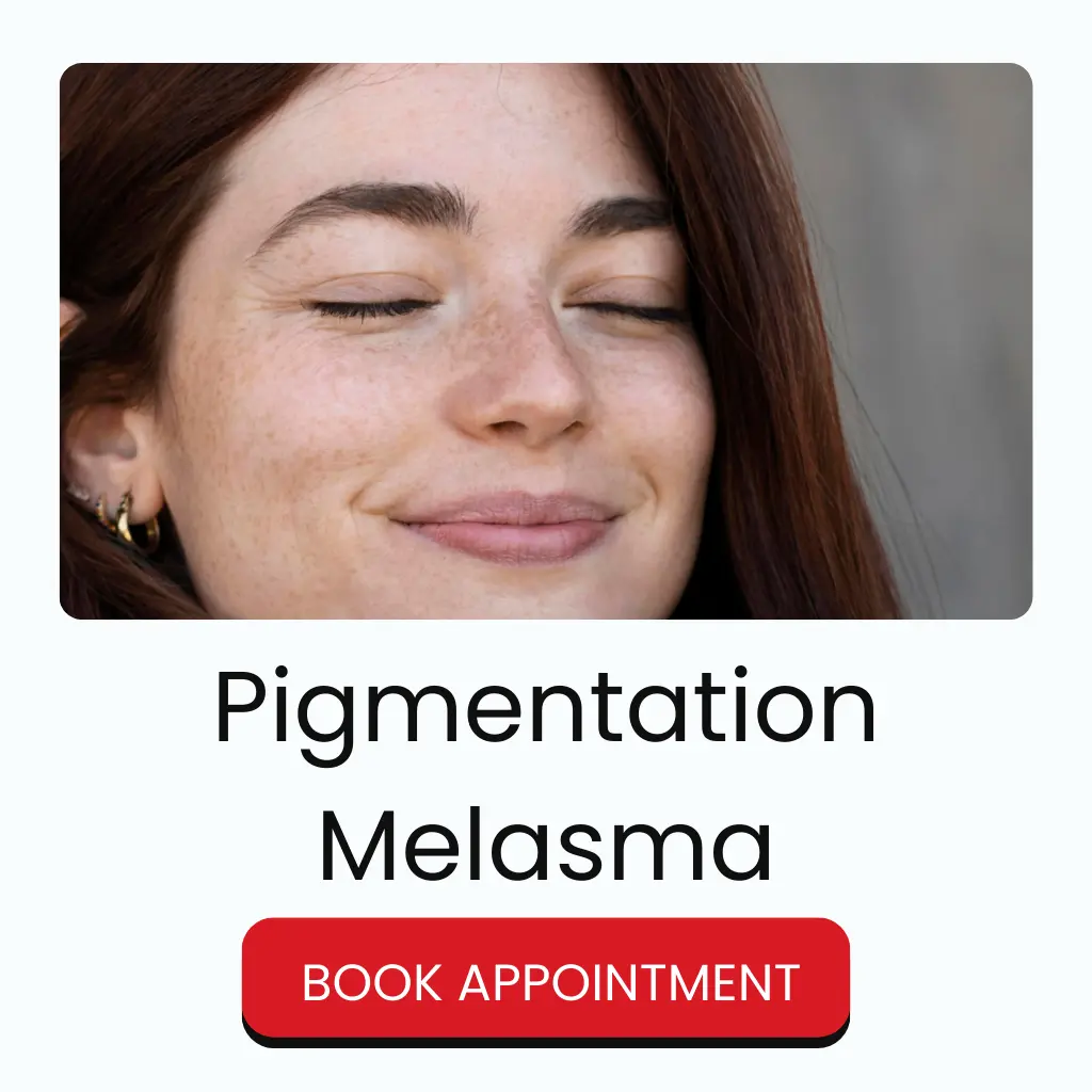 Pigmentation and Melasma Treatment in Durgapur | Best Skin Clinic Dr. Paul’s Aesthetic Clinic