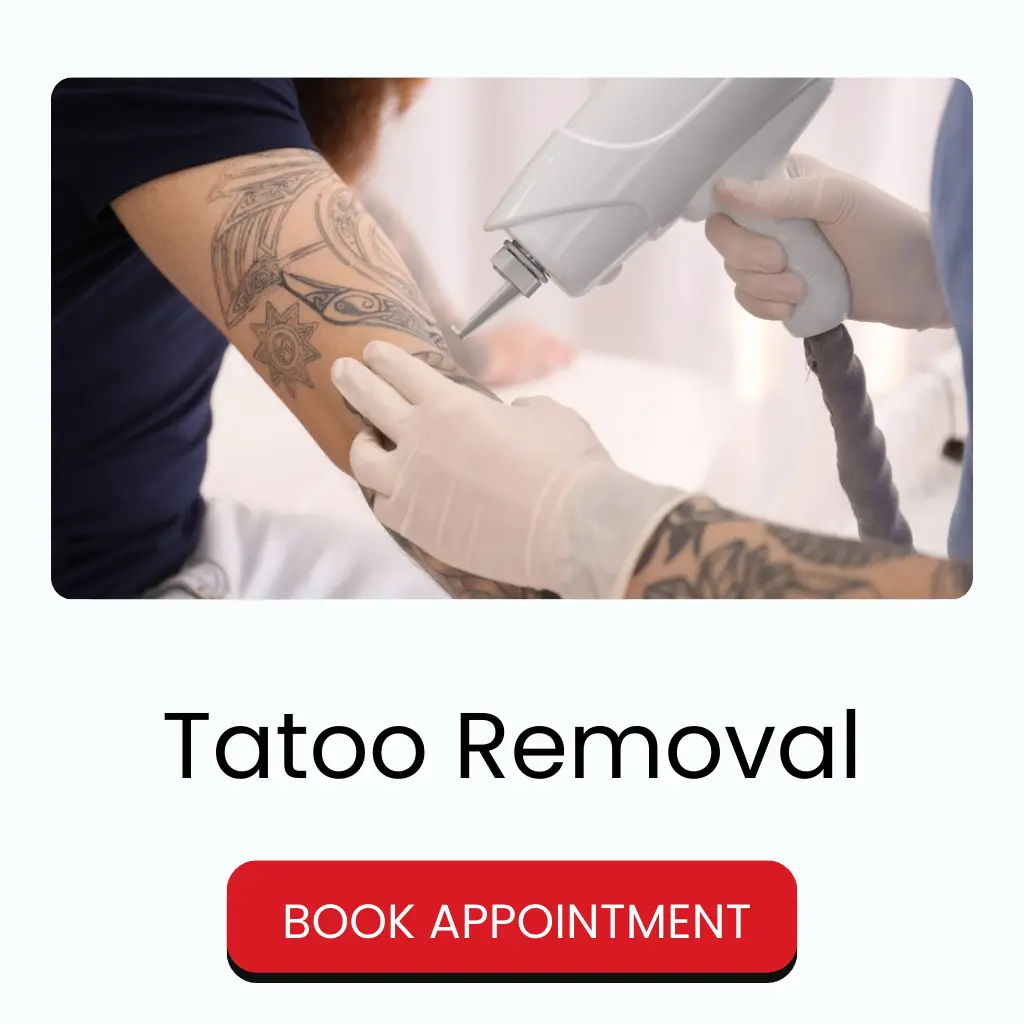 Tattoo Removal Treatment in Durgapur | Dr. Paul’s Aesthetic Clinic