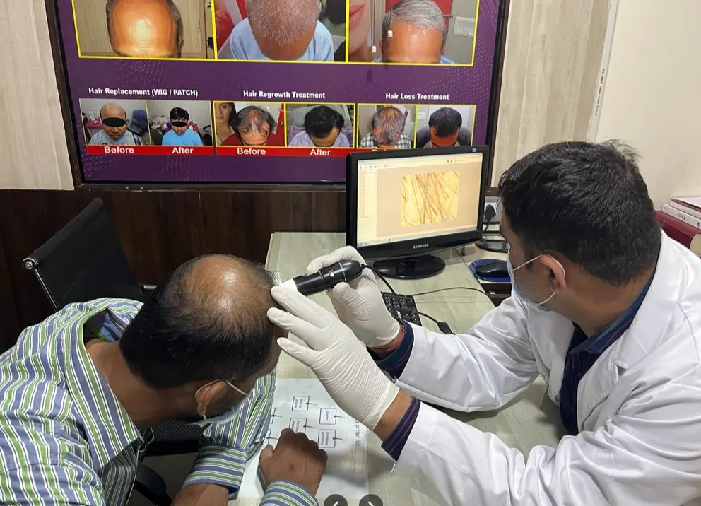 hair loss treatment in durgapur